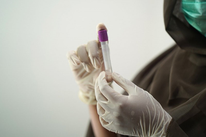 A person holding a blood test sample